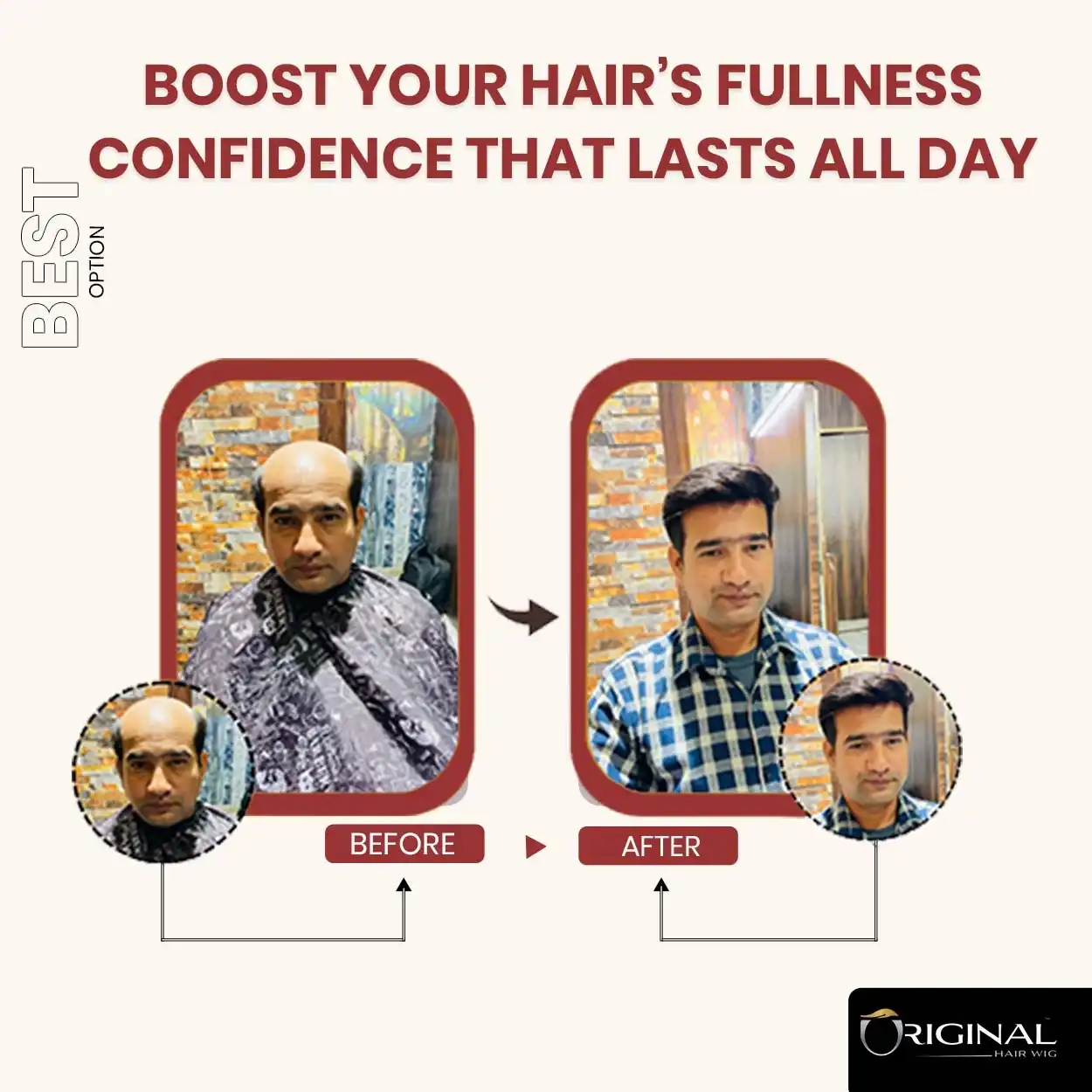 Natural Black Golden Hair Patch Easy Fix with Tape Glue and Clips